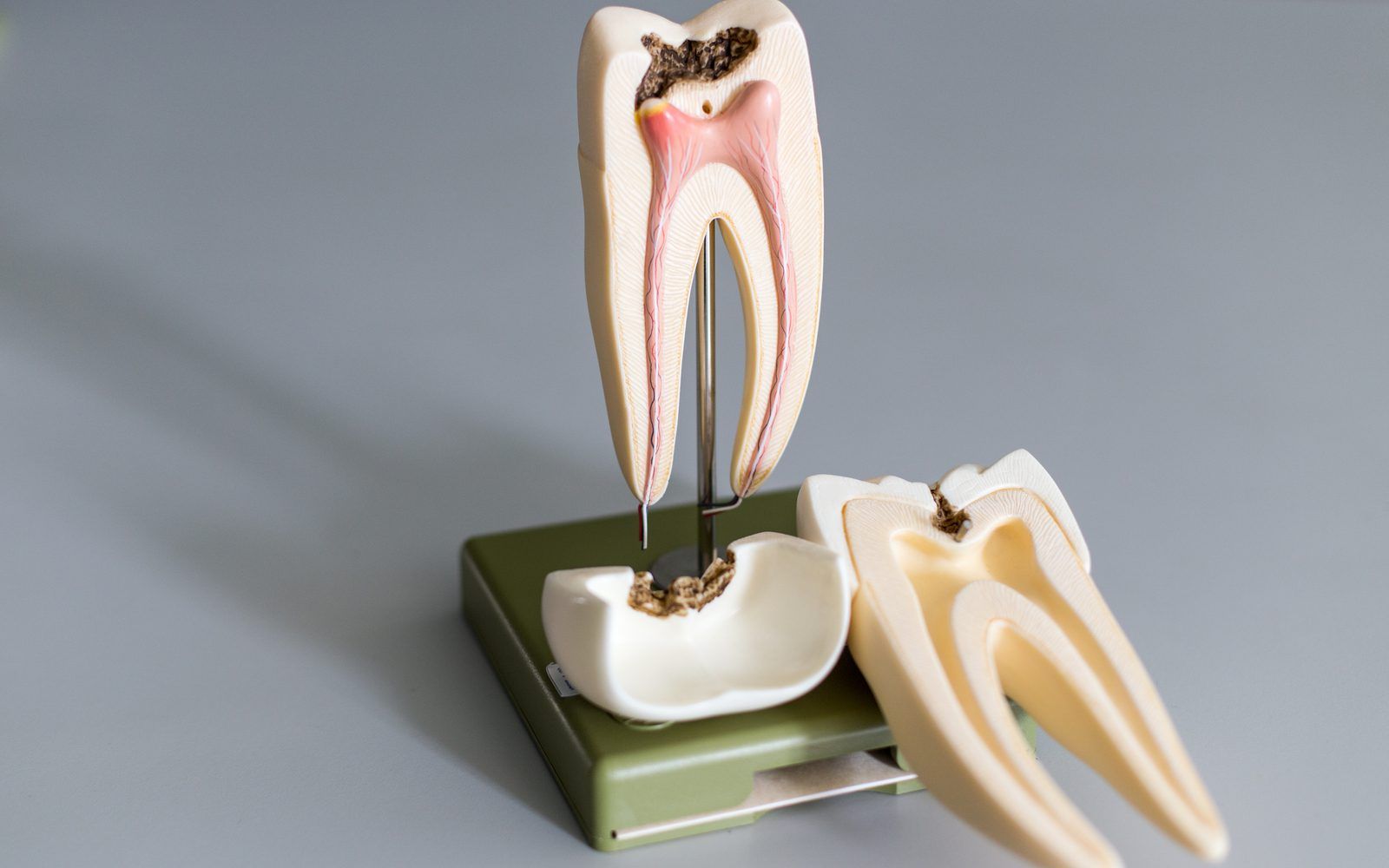 Root Canals Model