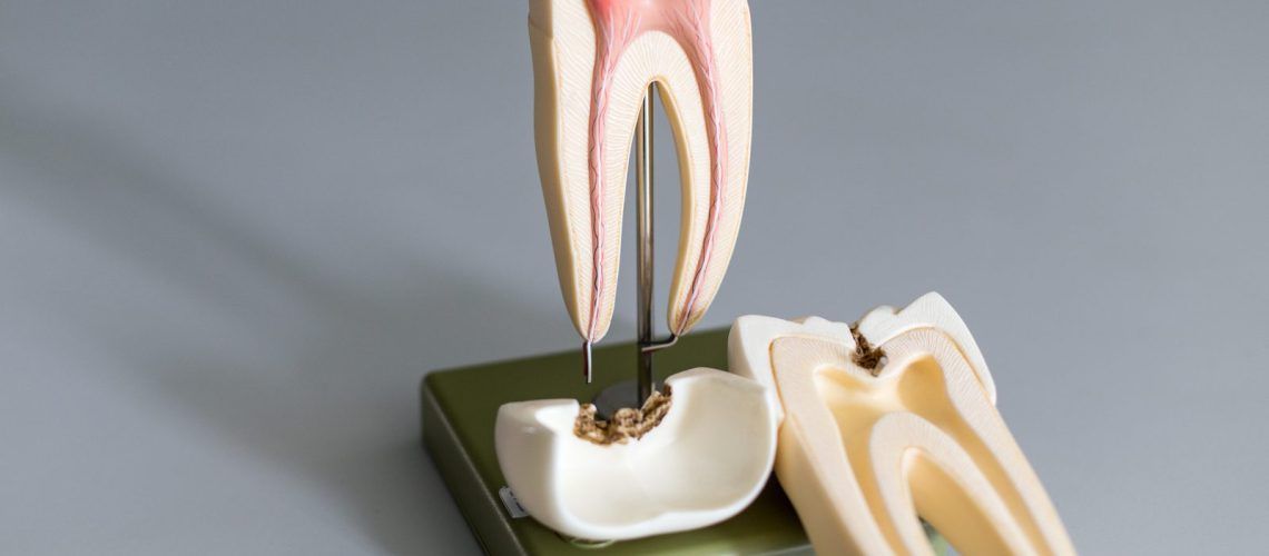Root Canals Model