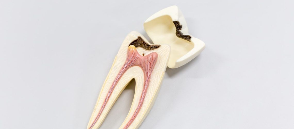 Tooth Root Model
